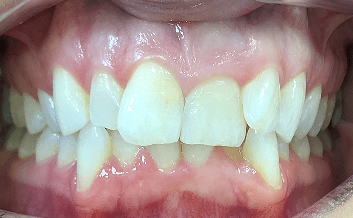 Before - Church Street Dental