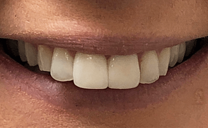 Before - Church Street Dental