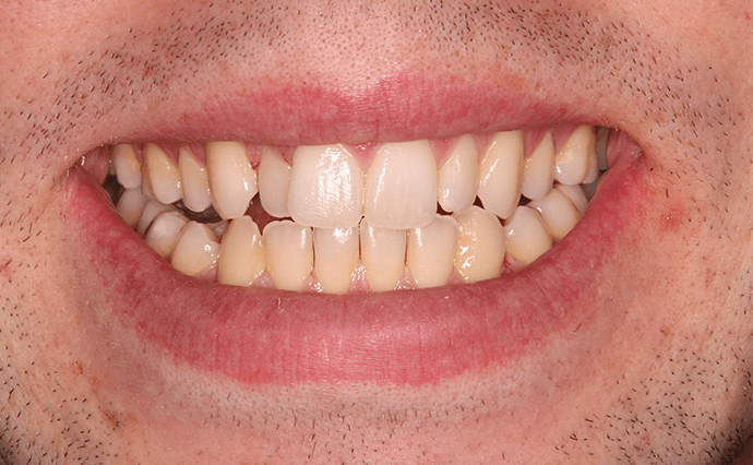 Before - Church Street Dental